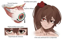 carmen (project moon), project moon, lobotomy corporation, sostenudo, post #6024
